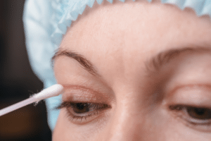 eyelid surgery