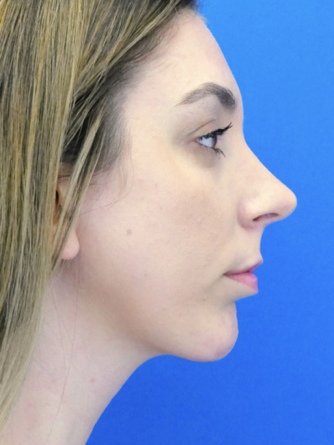 Facial Profile Balance