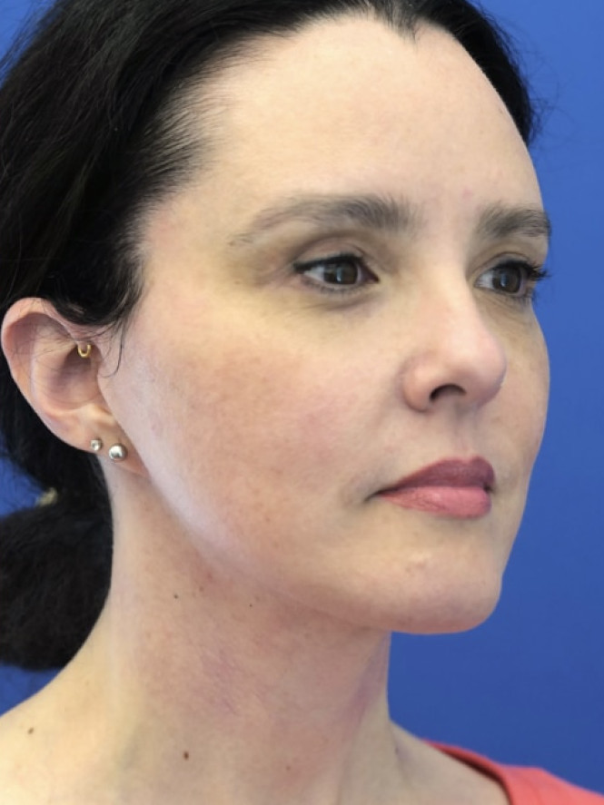 Awesome Jawline